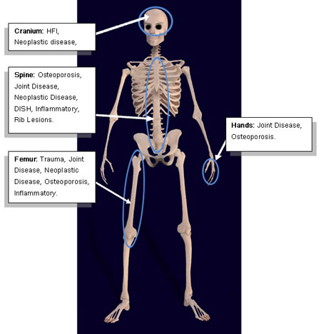 A model of a male human skeleton with labelled body parts.