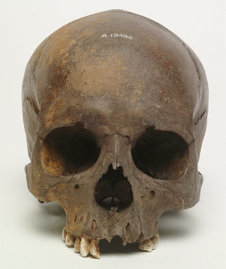 Bronze age skull