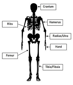 Identification of Skeletal Elements